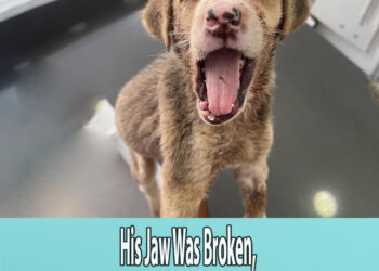 His Jaw Was Broken, He Couldn’t Close His Mouth And Was In A Lot Of Pain