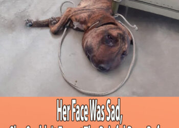 Her Face Was Sad, She Couldn’t Forget The Painful Days Before