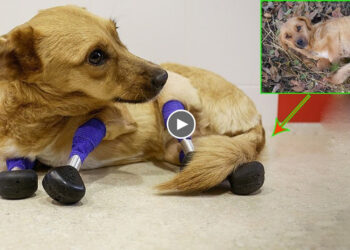 A Miracle Happened to The Girl Who Had Crushed Legs, Was Thrown Into The Deep Forest