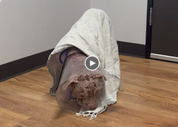 After Many Hurts in the Past, Now She Needs More Love