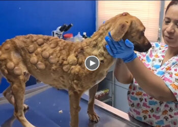 Giant Tumors Will Never Make Her Fall, They Will Make Her Stronger